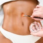 Body Contouring and Sculpting: Precision Body Shaping