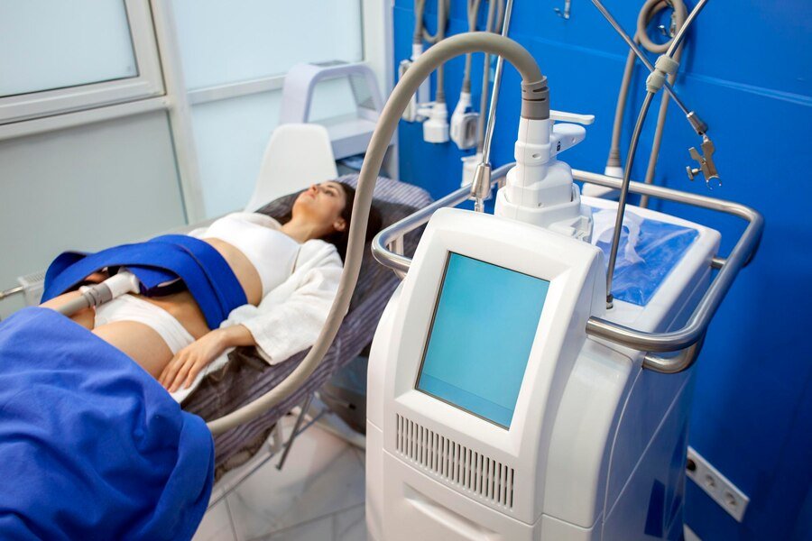CoolSculpting Services