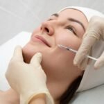 Juvederm Session