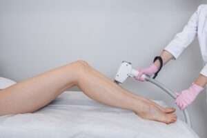 Hair Removal