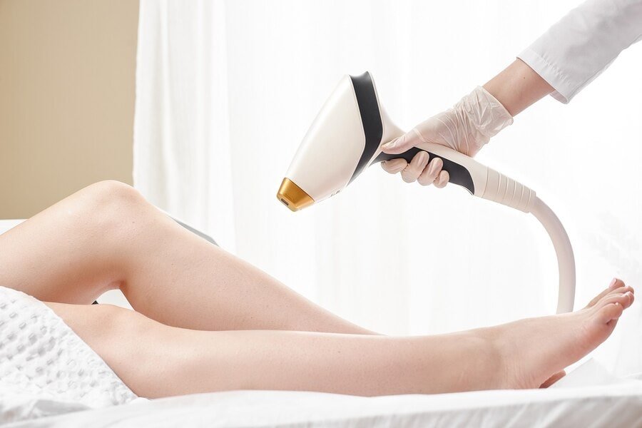 Laser Hair Removal
