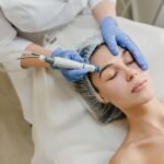 Microneedling Session