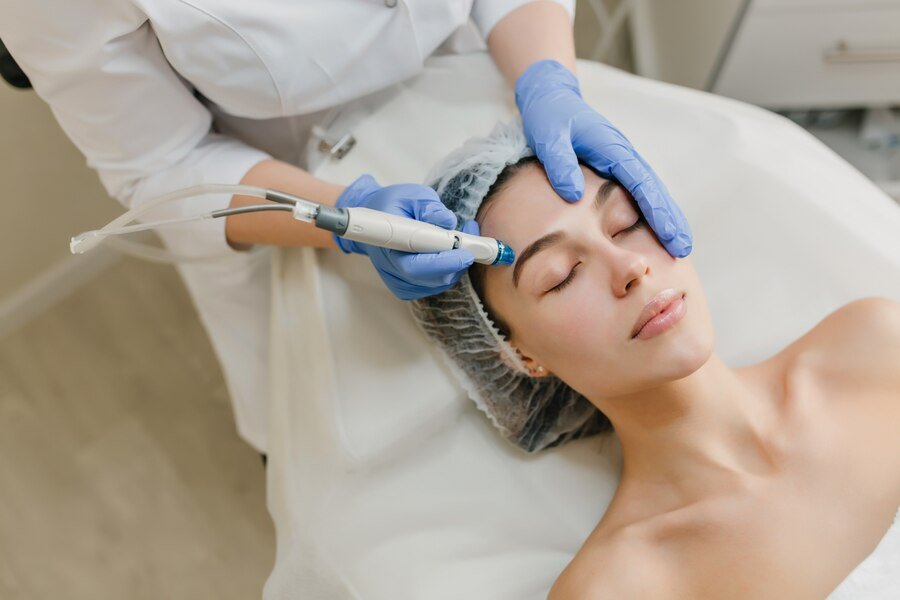 Microneedling Session