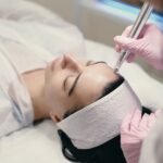Microneedling