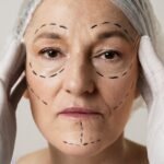Wrinkle Reduction