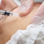 clinic-specialist-injects-concentrated-hyaluronic-acid-gel-get-rid-wrinkles-forehead-selective-focus_255755-4528
