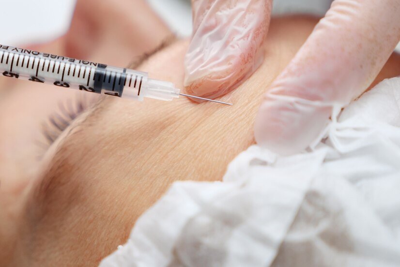 clinic-specialist-injects-concentrated-hyaluronic-acid-gel-get-rid-wrinkles-forehead-selective-focus_255755-4528