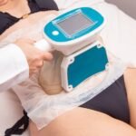 CoolSculpting Session