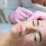 doctor-gives-injections-blood-plasma-into-face-young-girl_1089554-1429