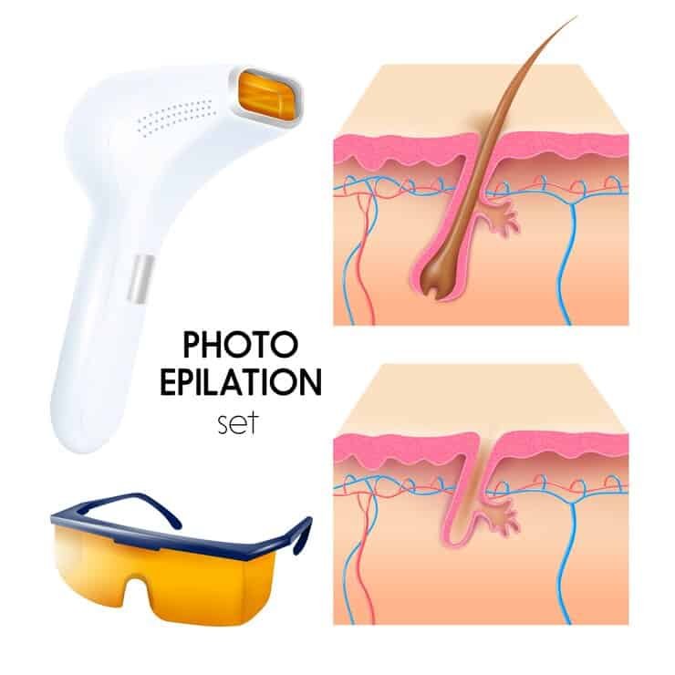 photo-epilation-realistic-illustration-set_1284-26503