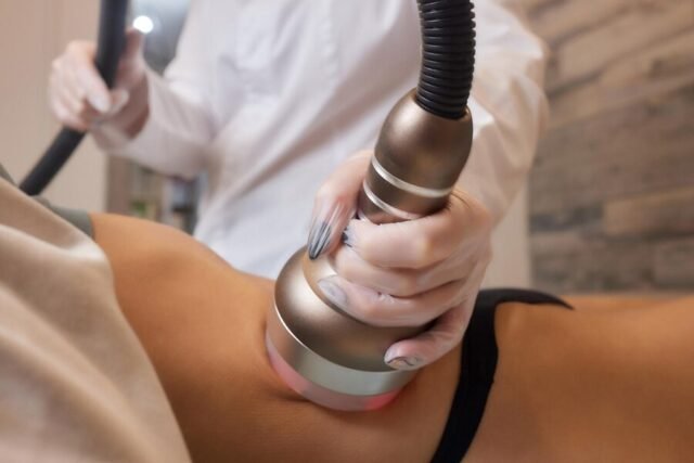 CoolSculpting Services