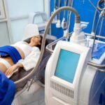 best CoolSculpting in Corpus Christi