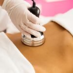 Coolsculpting El Paso