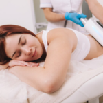 CoolSculpting Lubbock