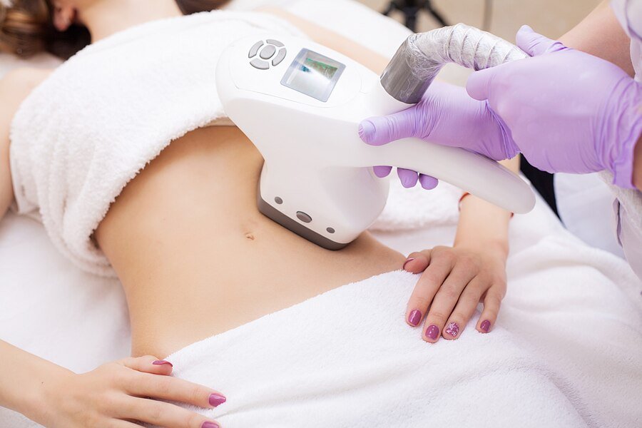 CoolSculpting Corpus Christi