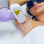 Laser Hair Removal El Paso