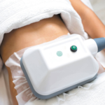 how-coolsculpting-stomach-treatment-can-transform-your-body