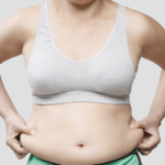 Fat Freezing El Paso