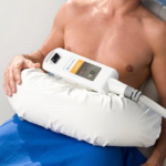 CoolSculpting for men