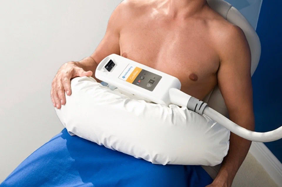 CoolSculpting for men