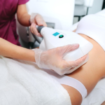 CoolSculpting in Corpus Christi