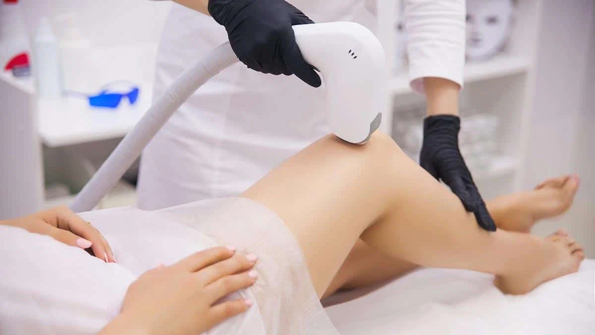 affordable laser hair removal