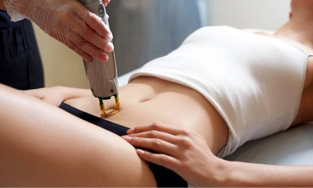Laser Hair Removal Specials Amarillo